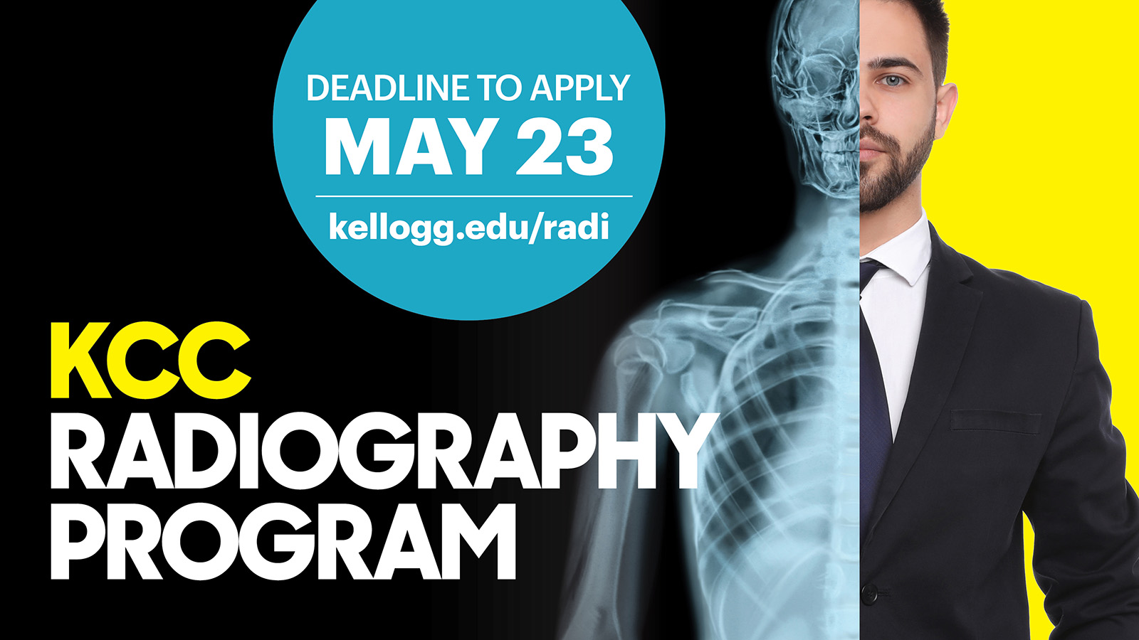A graphic showing a person half X-rayed and text that reads, "KCC Radiography Program. Deadline to apply May 23. kellogg.edu/radi."
